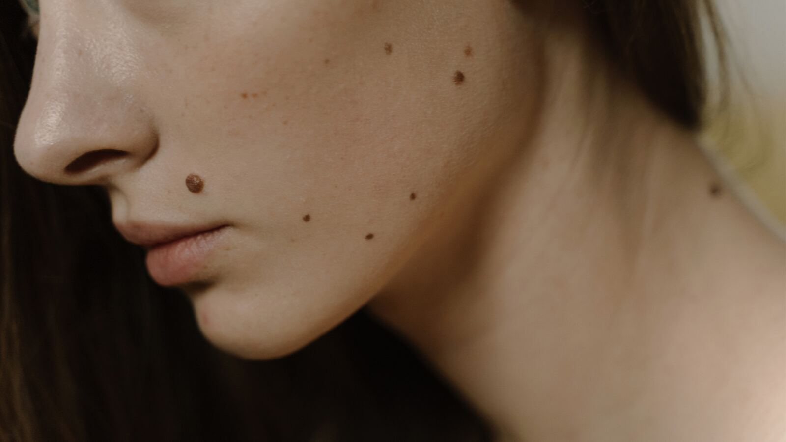 #SpotOn · Spot Treatment & Pigmentation